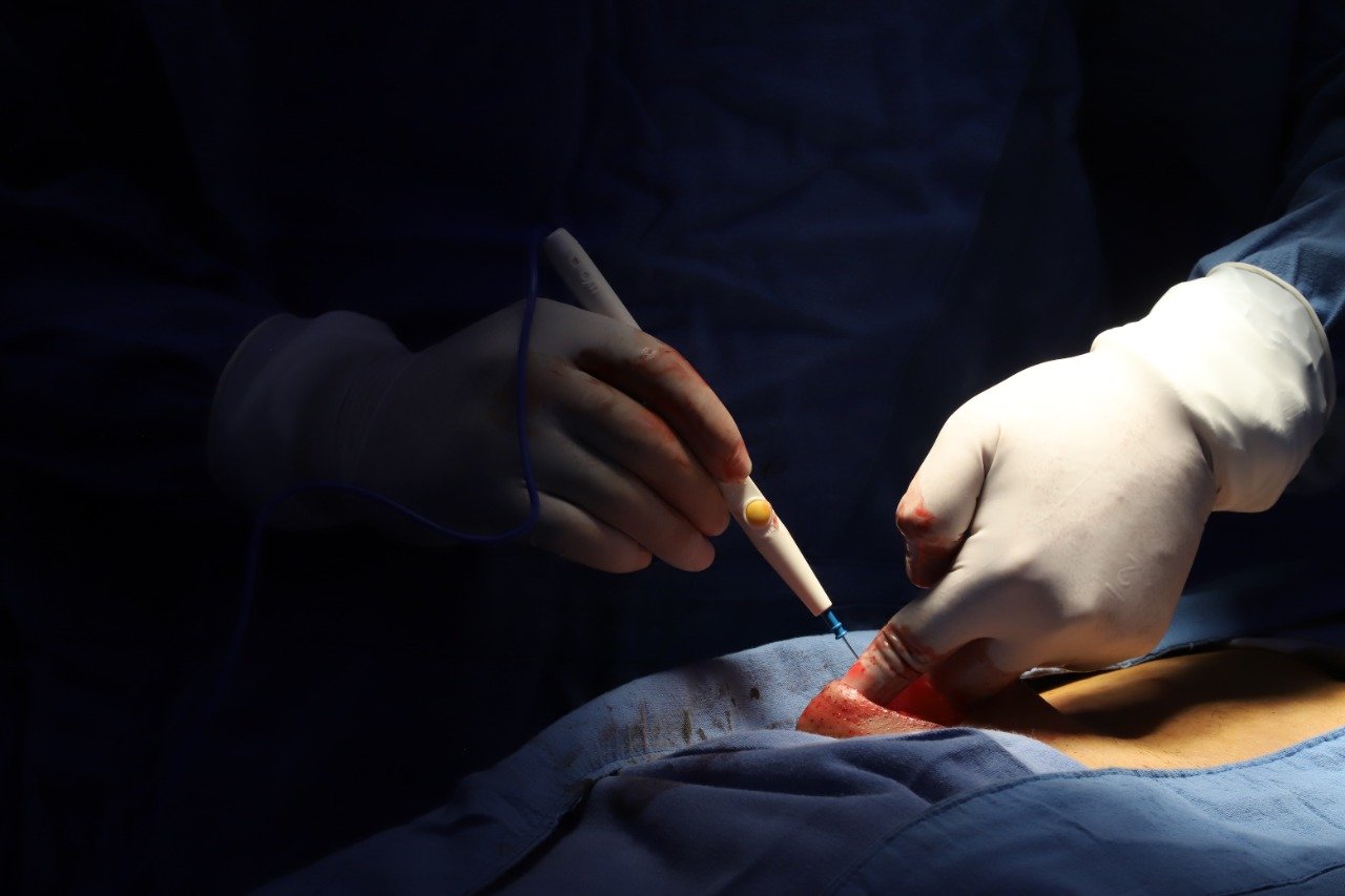Alerta SSM por clínicas que ofertan procedimientos quirúrgicos fuera de norma