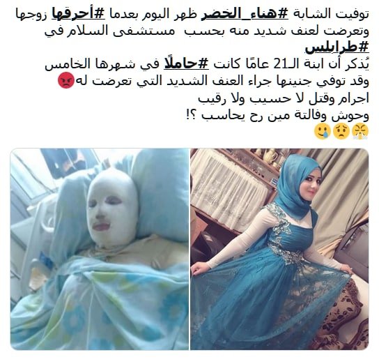 Mujer quemada por estar embarazada en Líbano