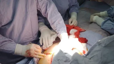 Una joven donó sus órganos a cuatro pacientes