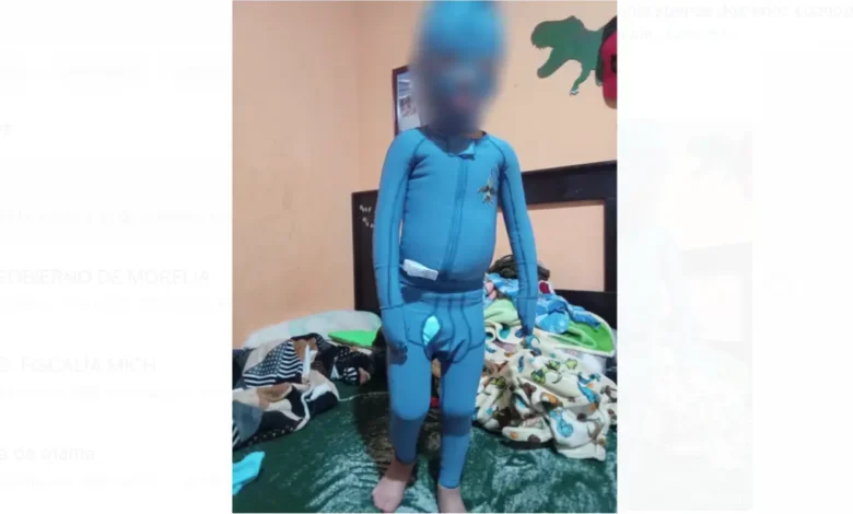Chuchito lanza un llamado de auxilio